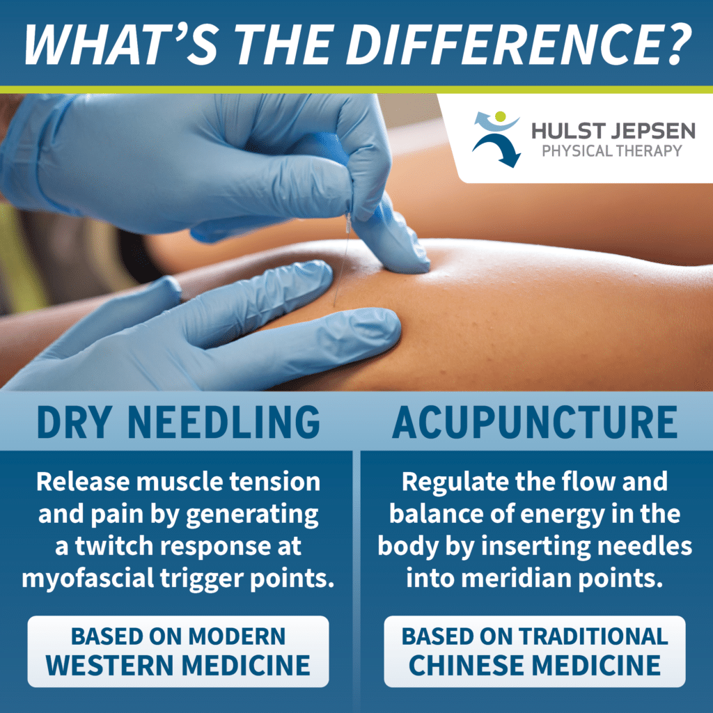 Dry Needling