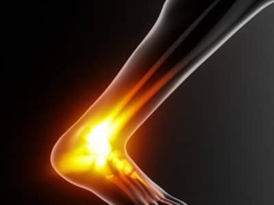 How to Navigate Achilles Tendon Ruptures and Recover Fully